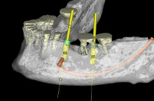 CT scan