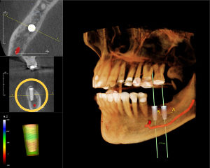 CT scan