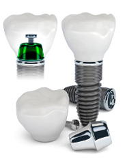 Dental implants