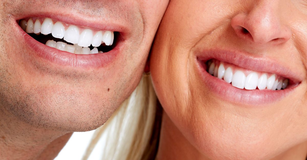 Smile. Fogpótlás akció